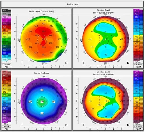 Szemészeti vizsgálat felvétel